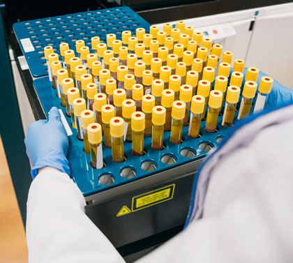 An image of a research worker holding a tray full of vials