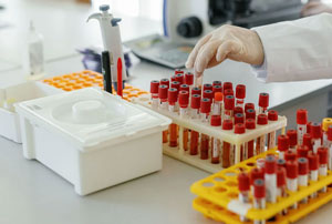 An image of a chemist analyzing samples in a modern lab