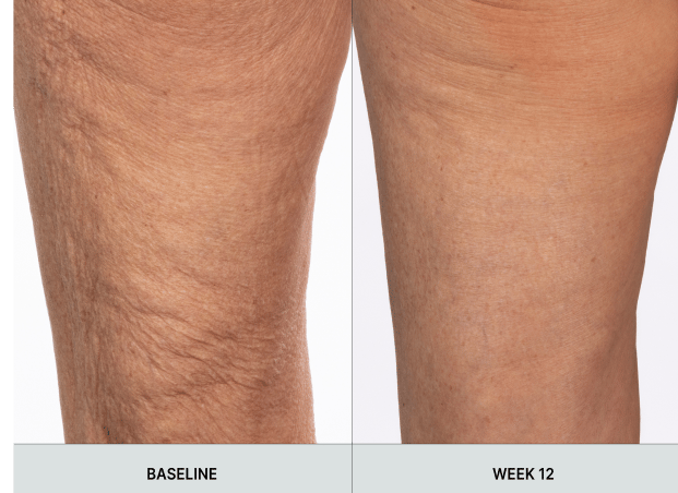 NU SKIN ageLOC WellSpa iO セット Nuskin nu skin ageloc WellSpa io + ageLOC WellSpa iO Body