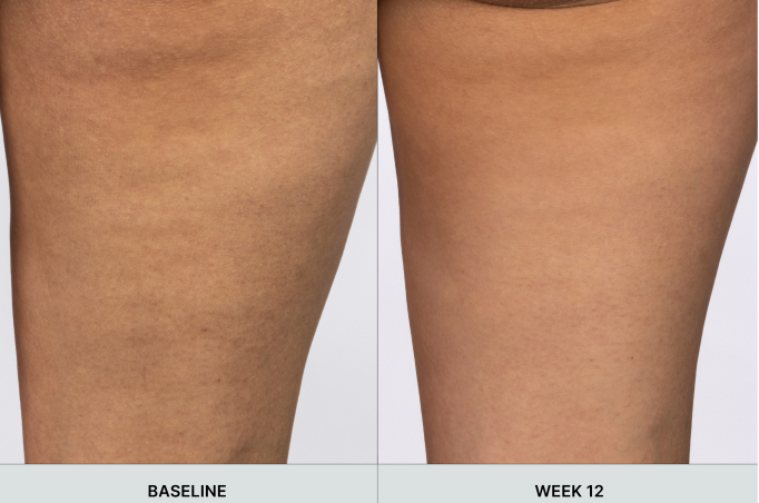 ageLOC WellSpa iO